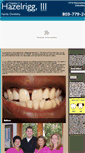 Mobile Screenshot of hazelriggdentistry.com